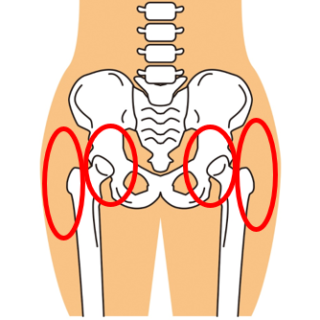 変形性股関節症とは？